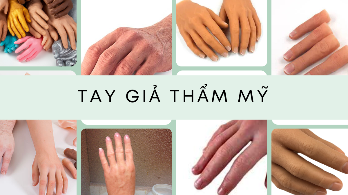 Tay giả thẩm mỹ