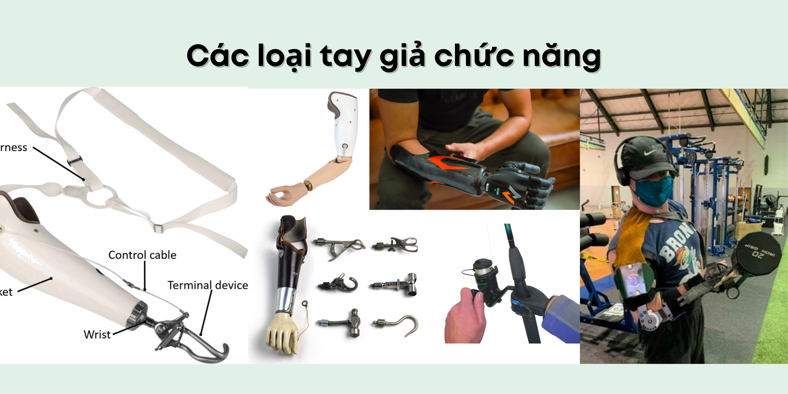Tay giả chức năng