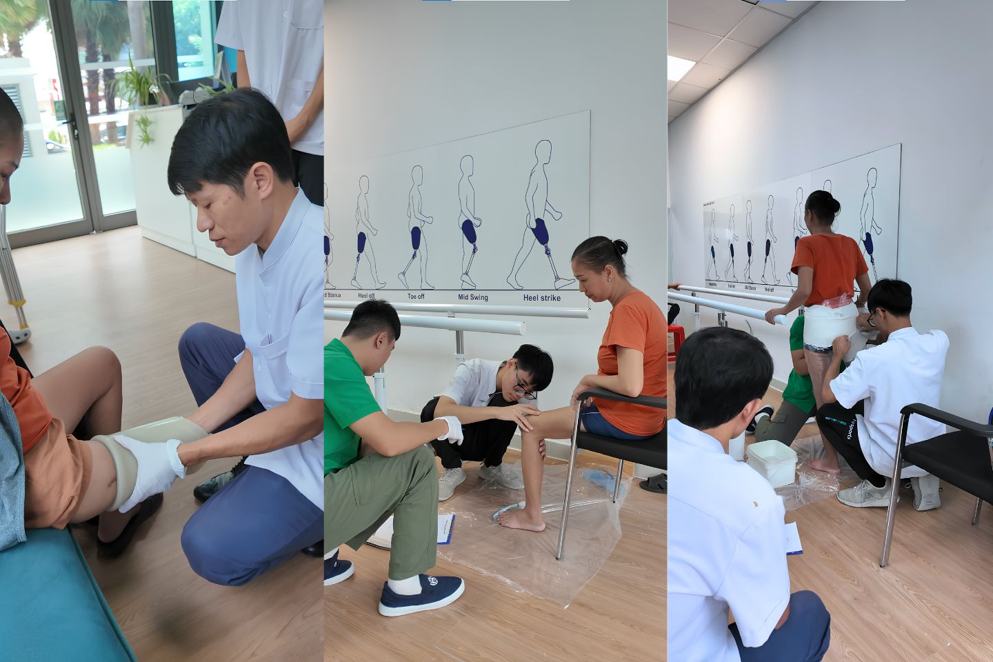 Đo và lấy khuôn lắp chân giả trên gối cho người mất 1 chân