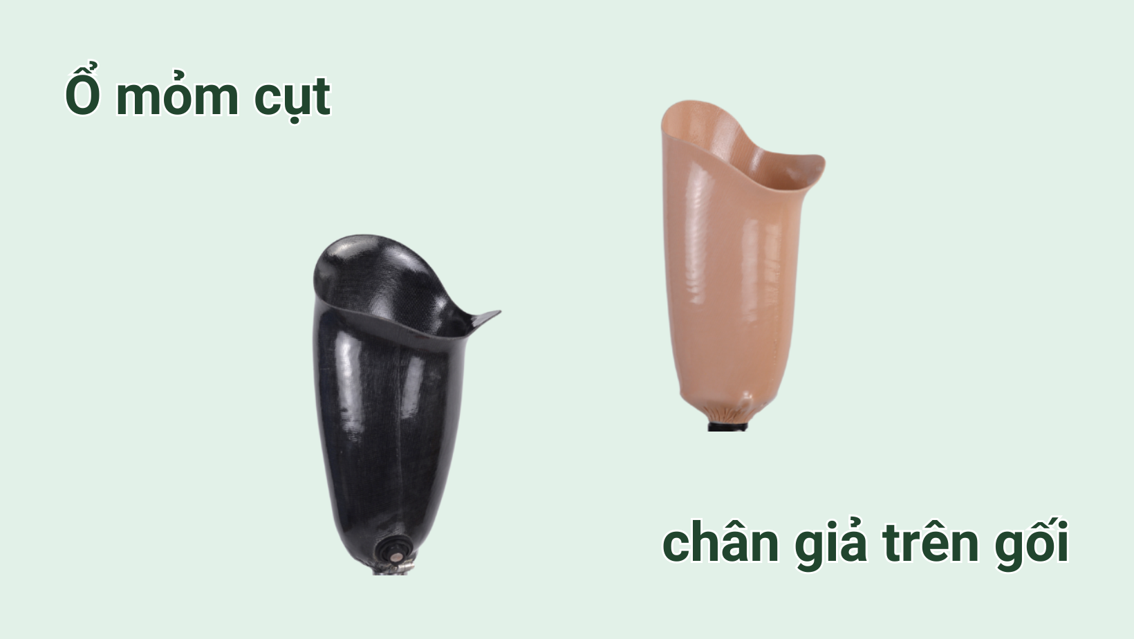 Chân giả trên gối