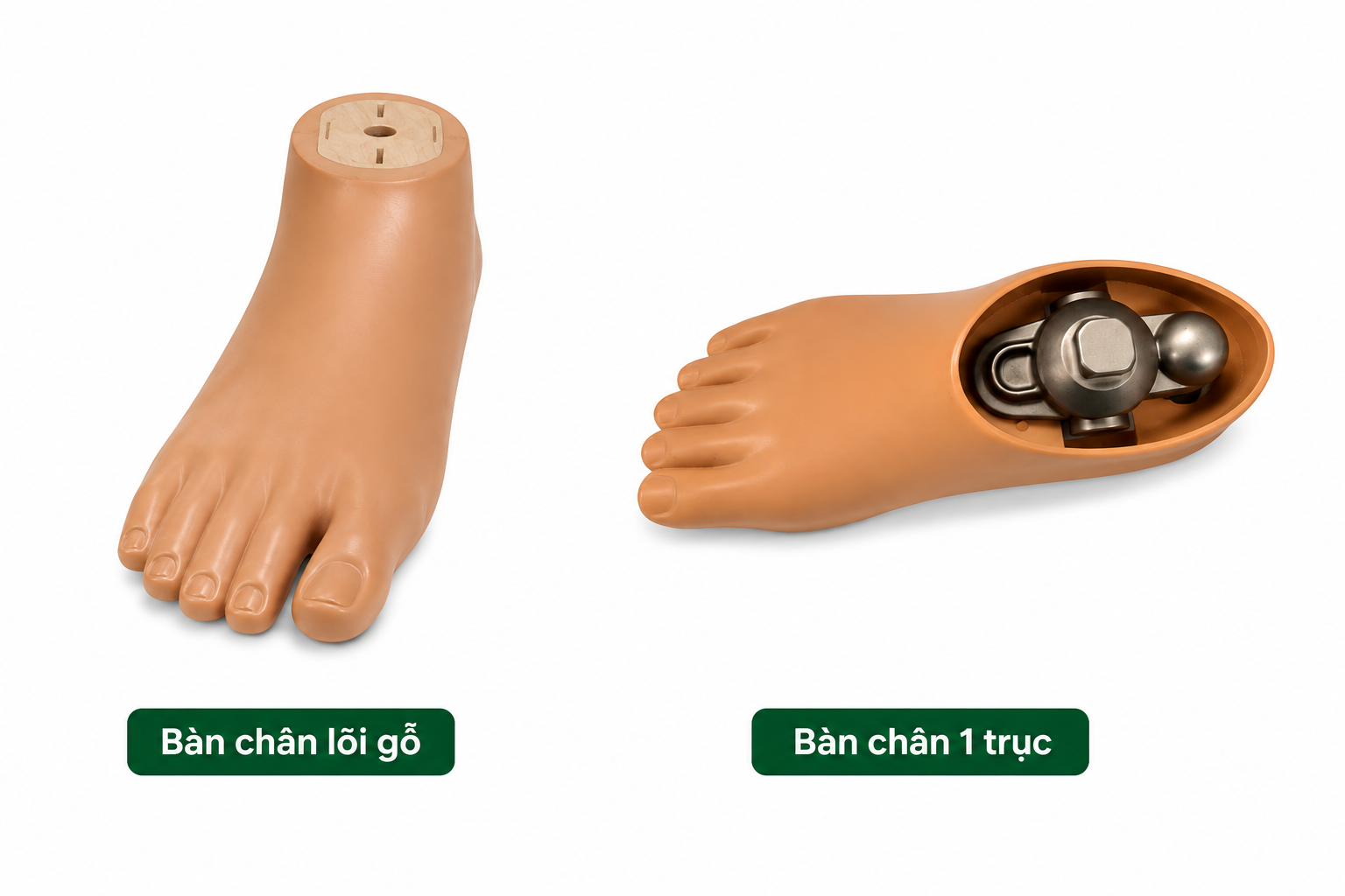 bàn chân giả 1 trục và bàn chân giả lõi gỗ