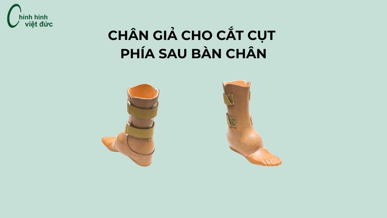 chân giả