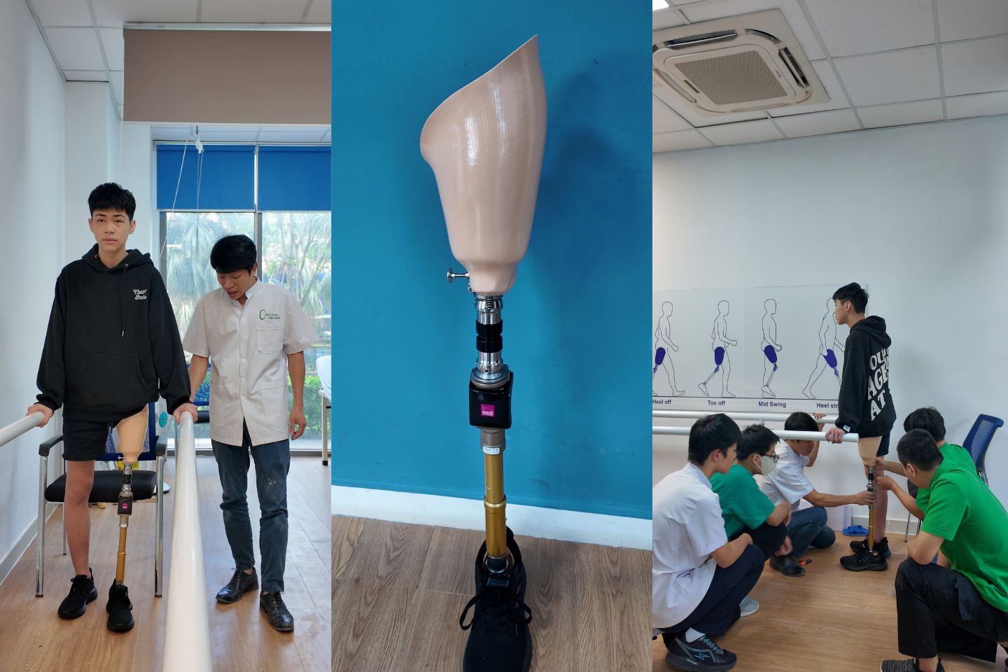 chân giả trên gối khớp đa trục