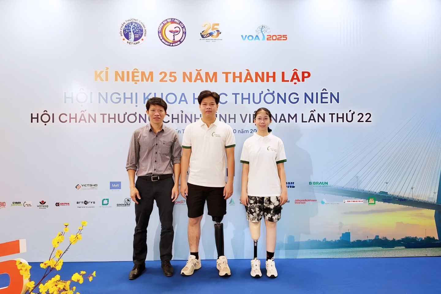 chuyên gia chân tay giả