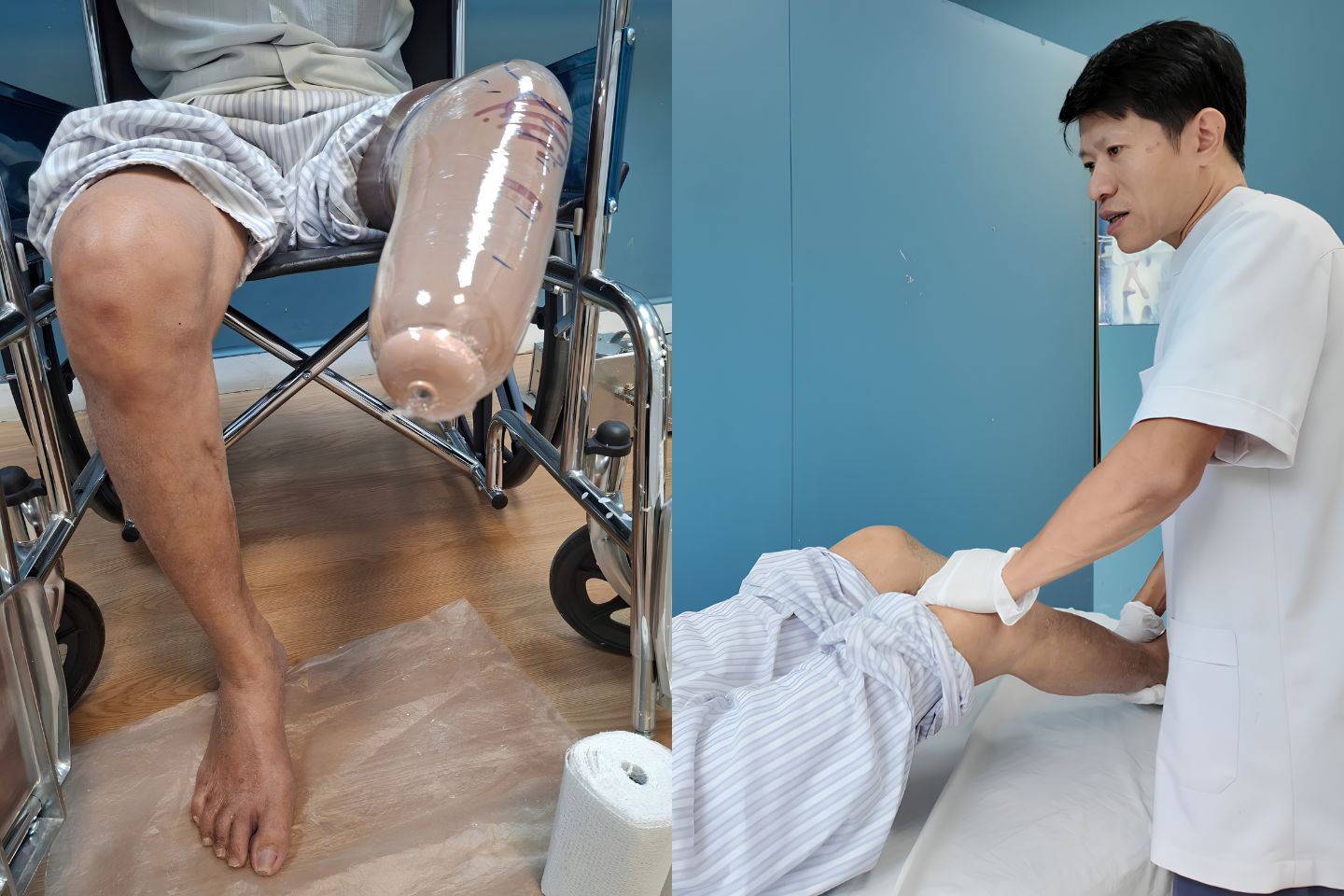 co gấp 2 khớp gối