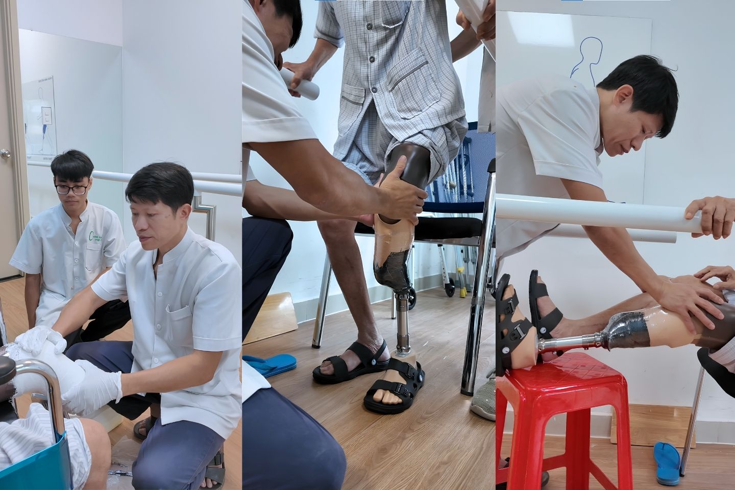 cứng 2 khớp gối có đi chân giả được không