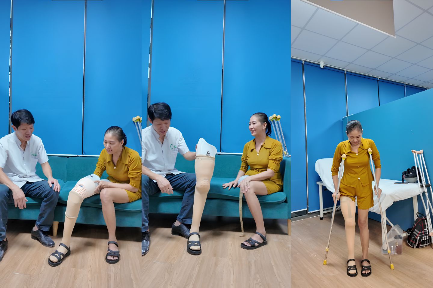 hoàn thiện chân giả trên gối cho chị Dung