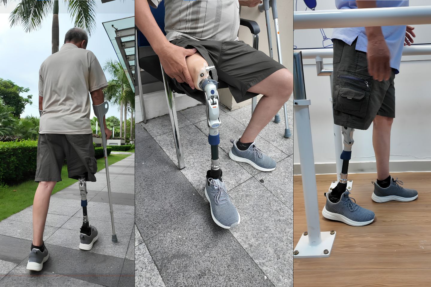 hướng dẫn tập đi chân giả trên gối an toàn
