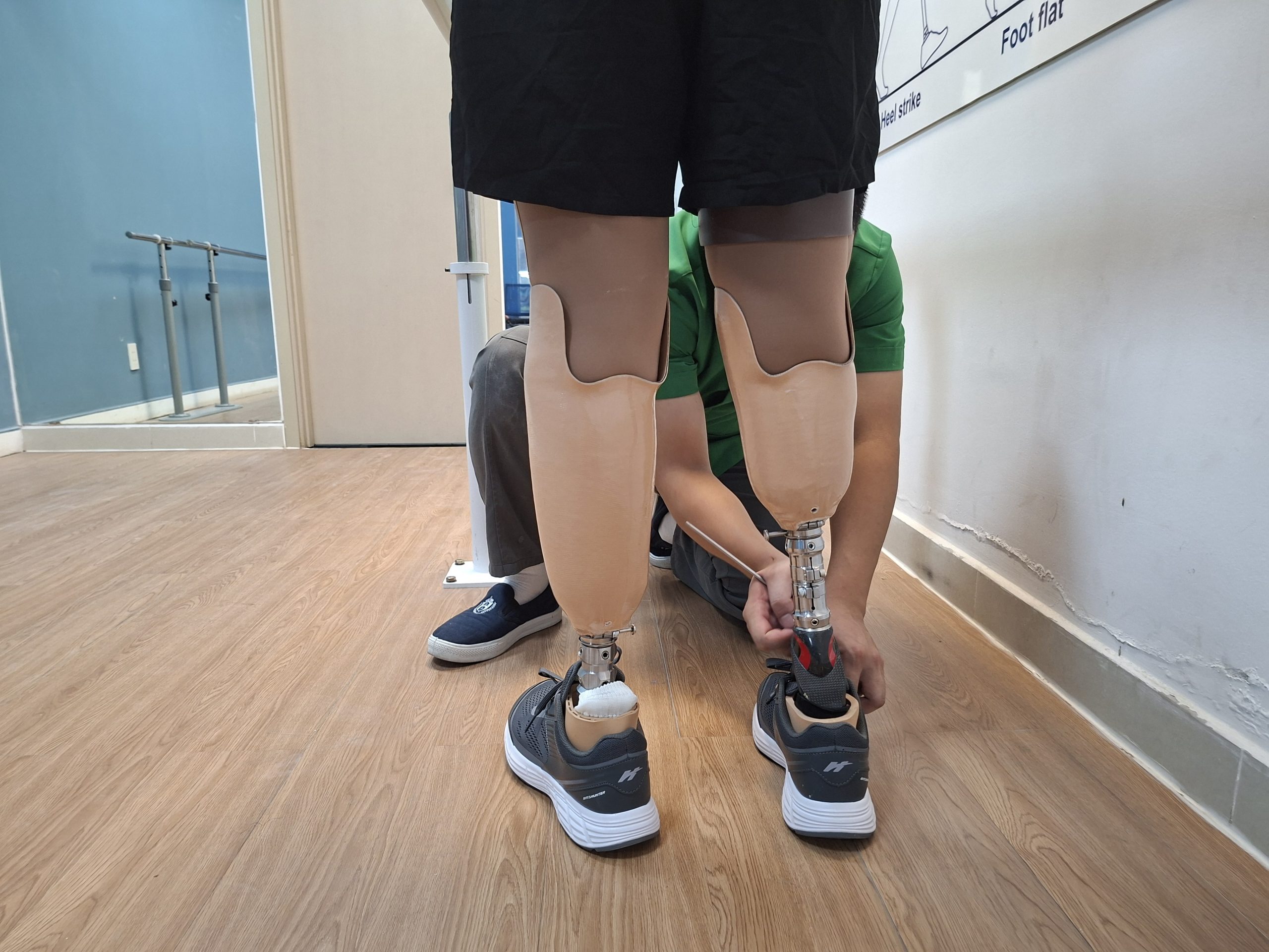 lắp 2 chân giả dưới gối