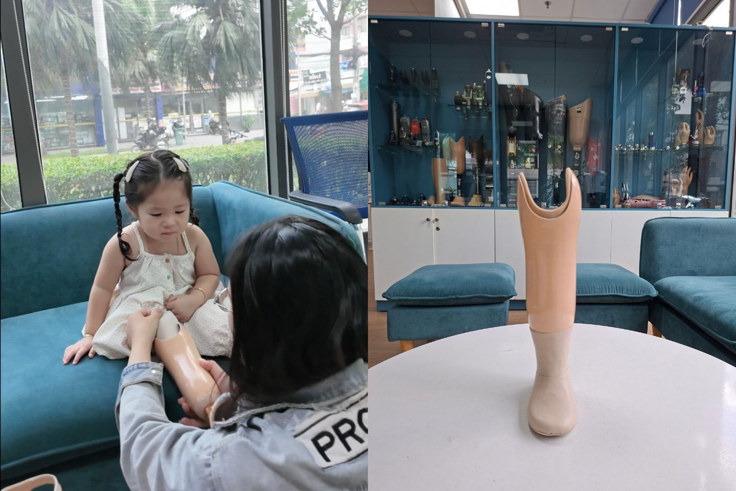 lắp chân giả cho em Cốm Thơm