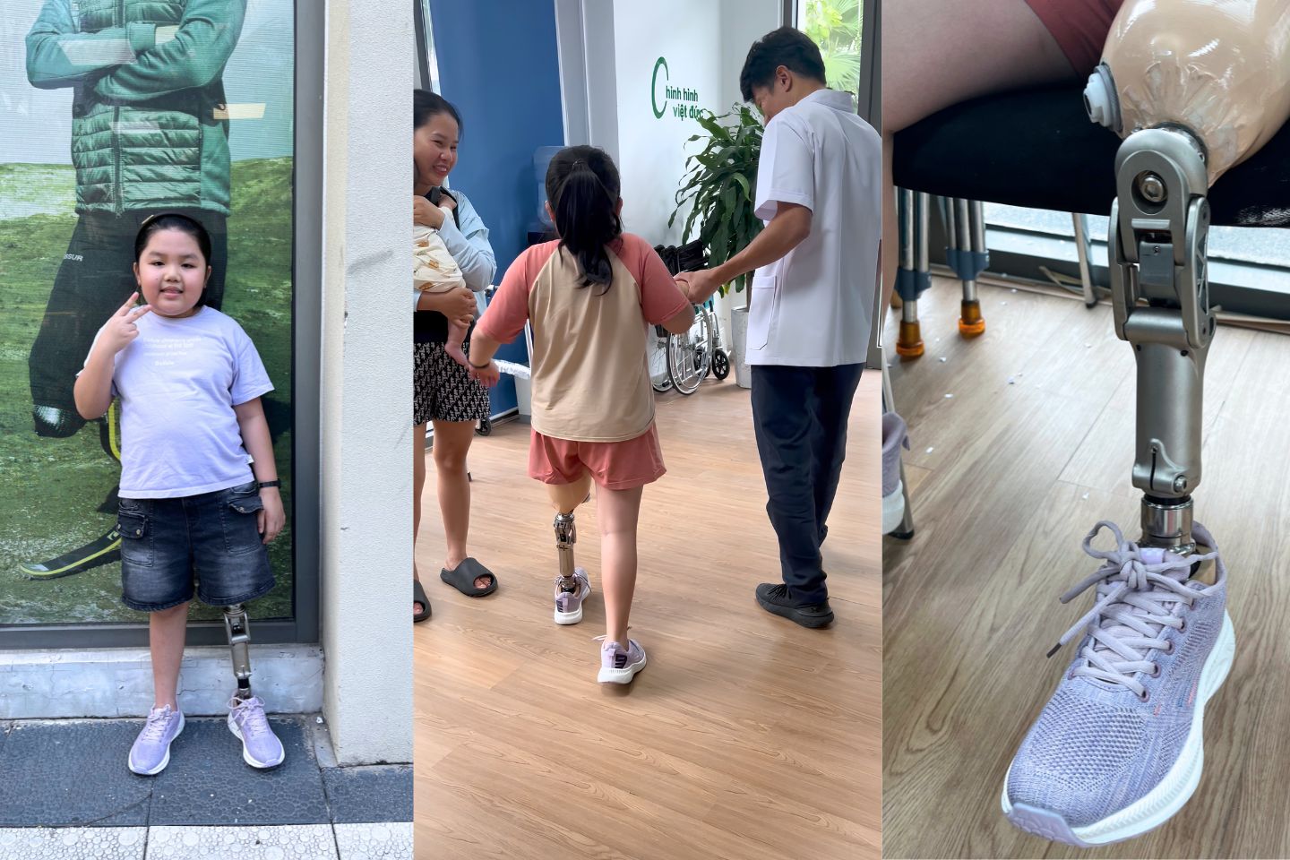 lắp chân giả trên gối cho trẻ em