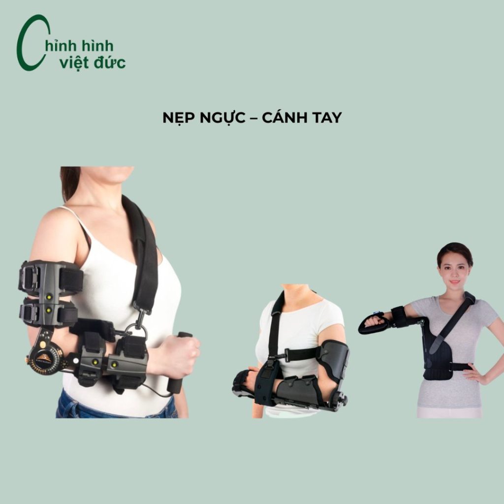 nẹp chi trên