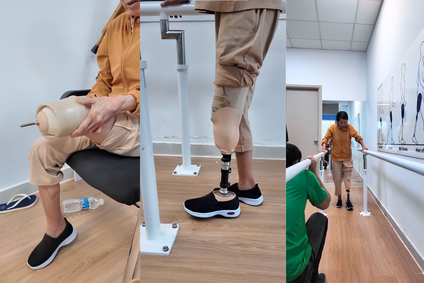 tập đi chân giả dưới gối