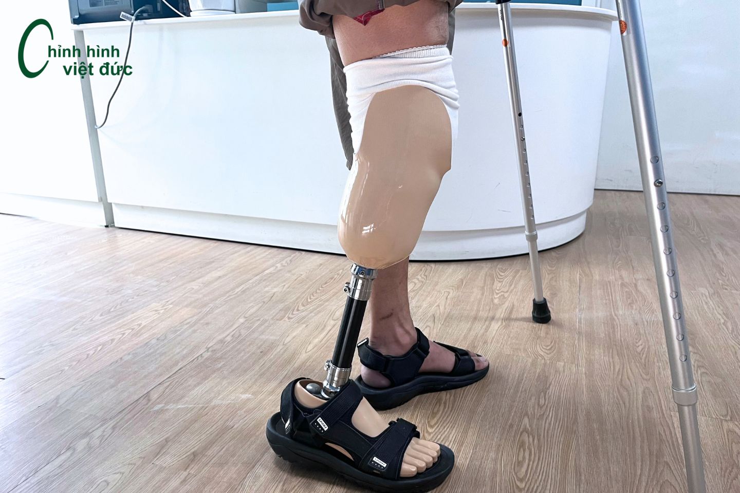 chân giả dưới gối bị co gấp khớp gối chân giả dưới gối bị co gấp khớp gối