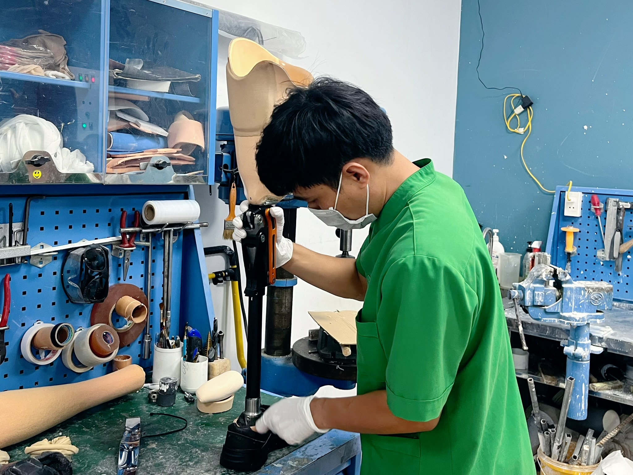 chi phí lắp chân giả bao gồm những gì