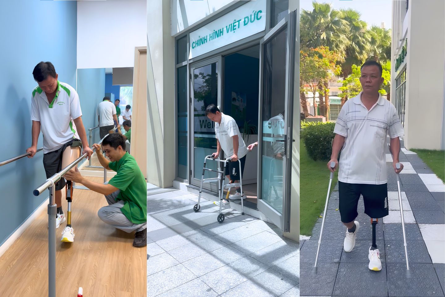 tập đi chân giả trên gối