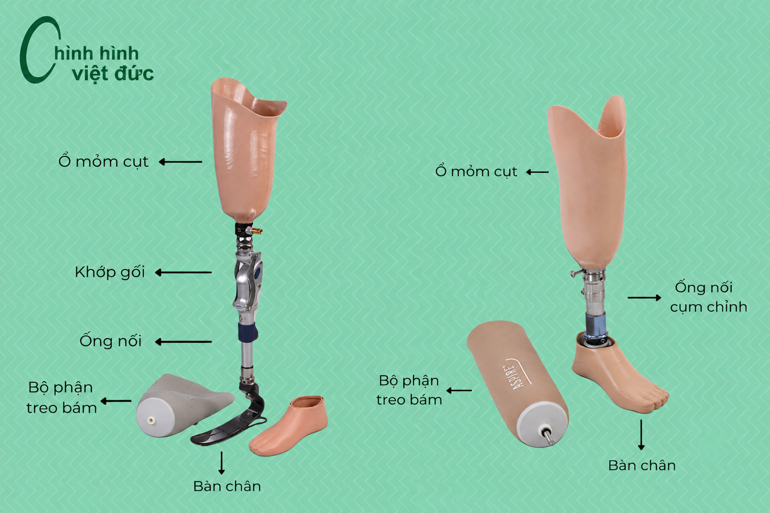 chân giả Chỉnh Hình Việt Đức